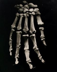 Image of Untitled (Bones)